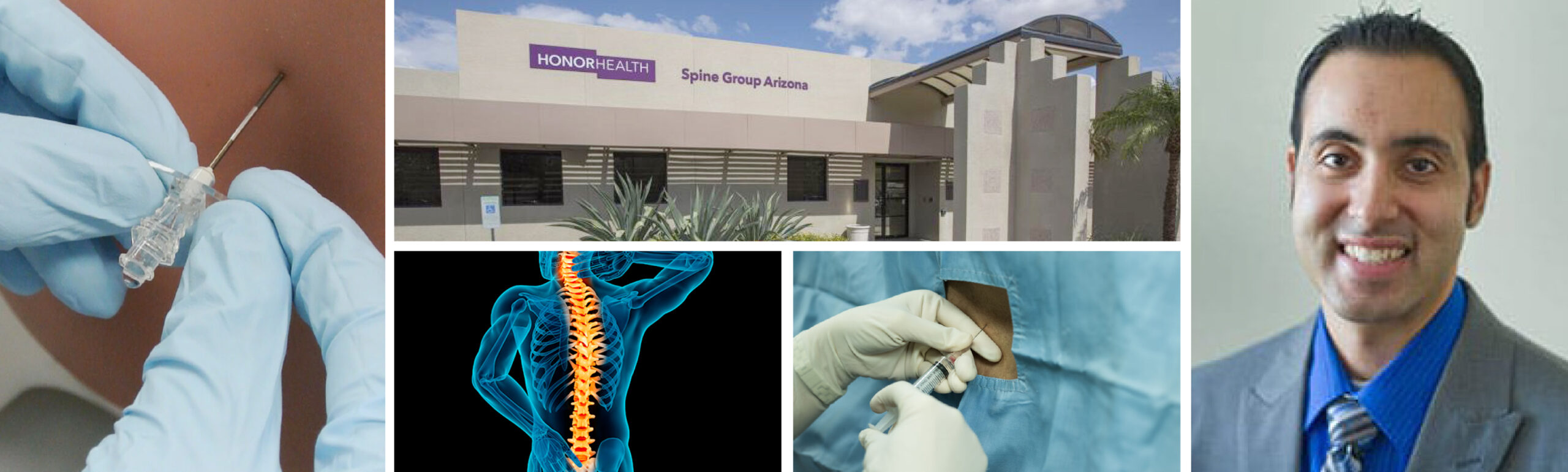 Spine Group Arizona is one of the best!